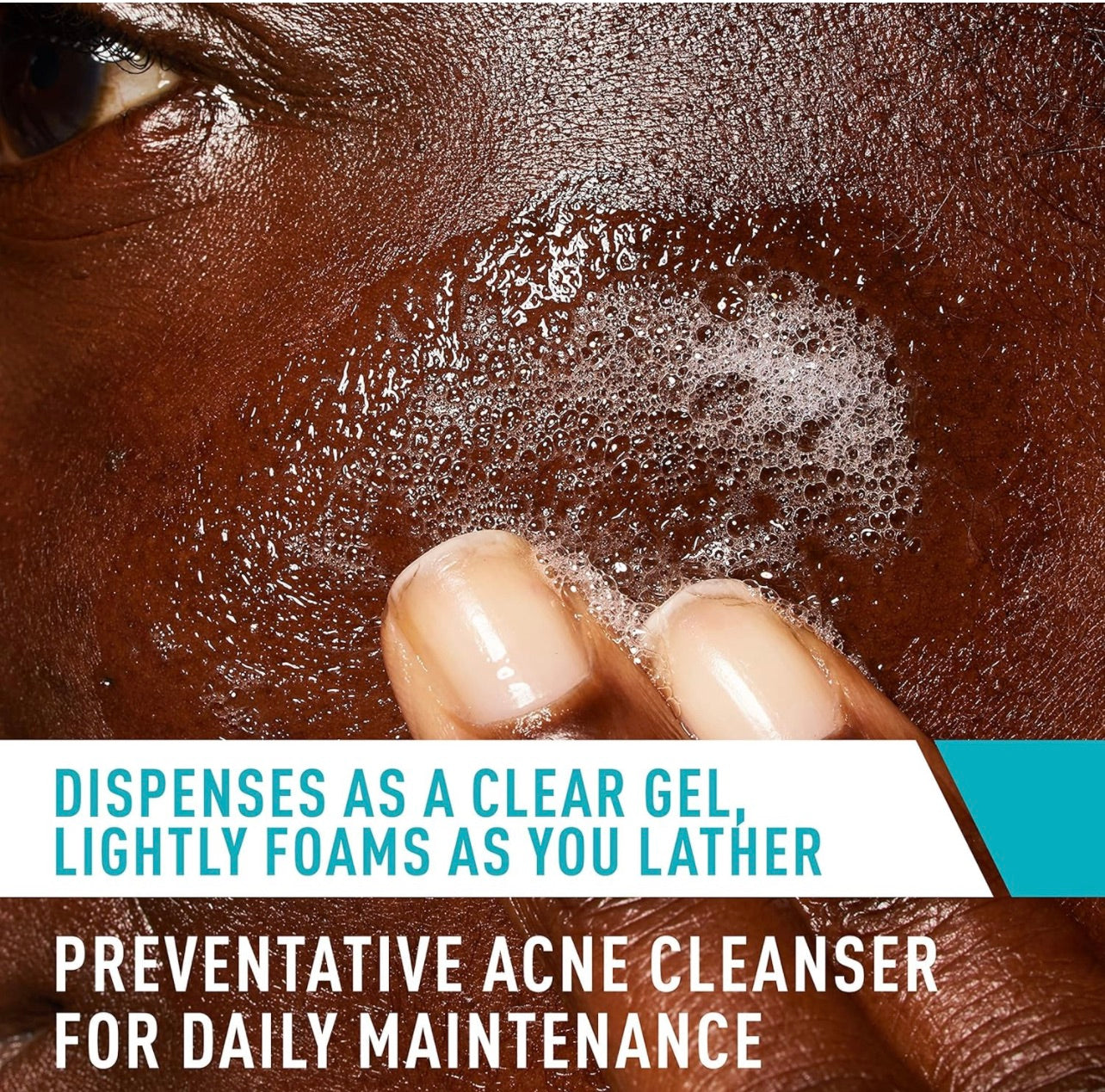 CERAVE ACNE CONTROL CLEANSER